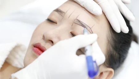 Endoscopic Brow Lift / Subbrow Ciliary Lift