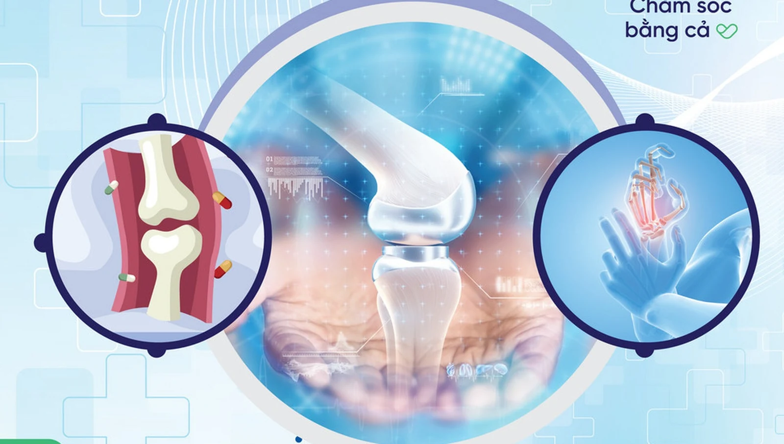 Orthopedics Department - Bệnh viện Đa khoa Quốc tế Sante