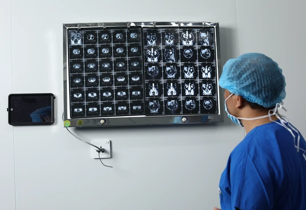 Specialist doctors at Sante General Hospital thoroughly evaluate diagnostic imaging and consult with the multidisciplinary medical team to formulate the optimal treatment regimen.