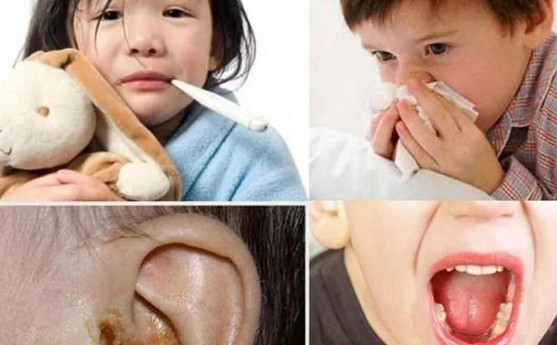 BEWARE OF EAR, NOSE, AND THROAT (ENT) CONDITIONS DURING THE YEAR-END SEASON - Image 3 - SANTE Hospital, Binh Thanh, HCMC