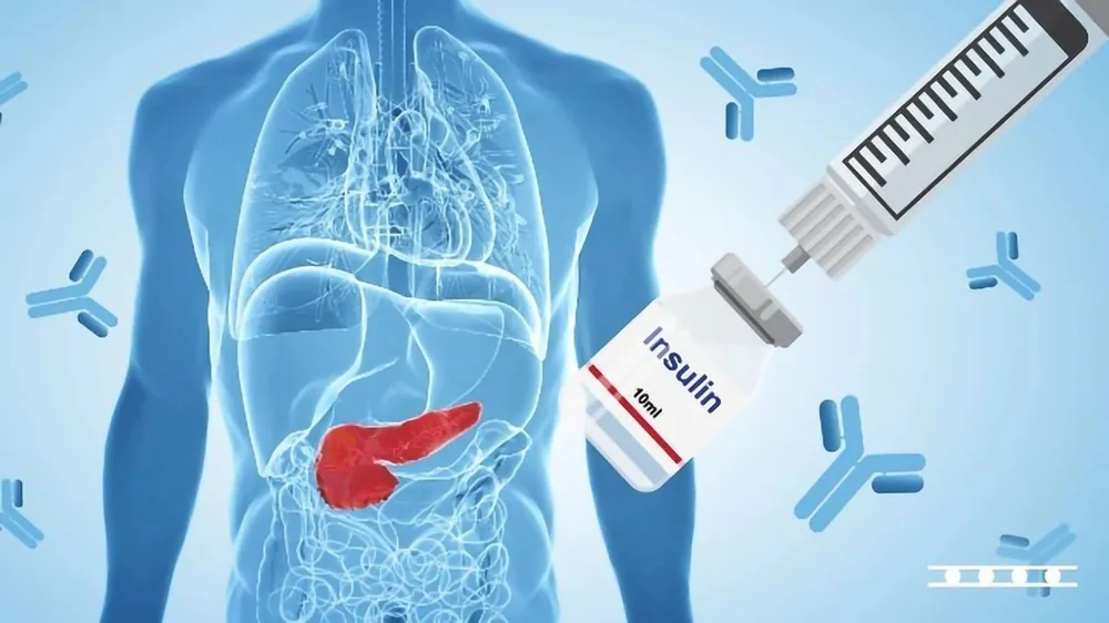 Diabetes: The "Silent" Culprit Behind Chronic Kidney Disease - Image 3 - SANTE Hospital, Binh Thanh District, HCMC