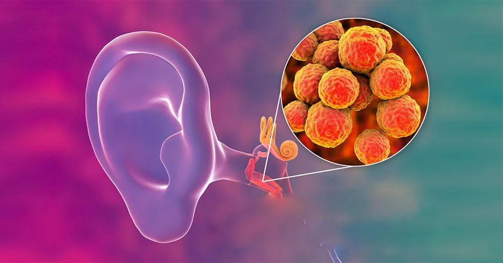 Understanding and Preventing Otitis Media - Image 2 - SANTE Hospital Binh Thanh, HCMC