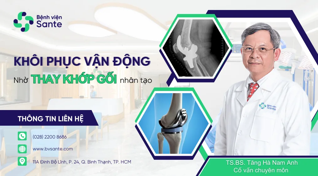 Restoring Full Mobility Through Total Knee Arthroplasty - SANTE Hospital, Binh Thanh, HCMC