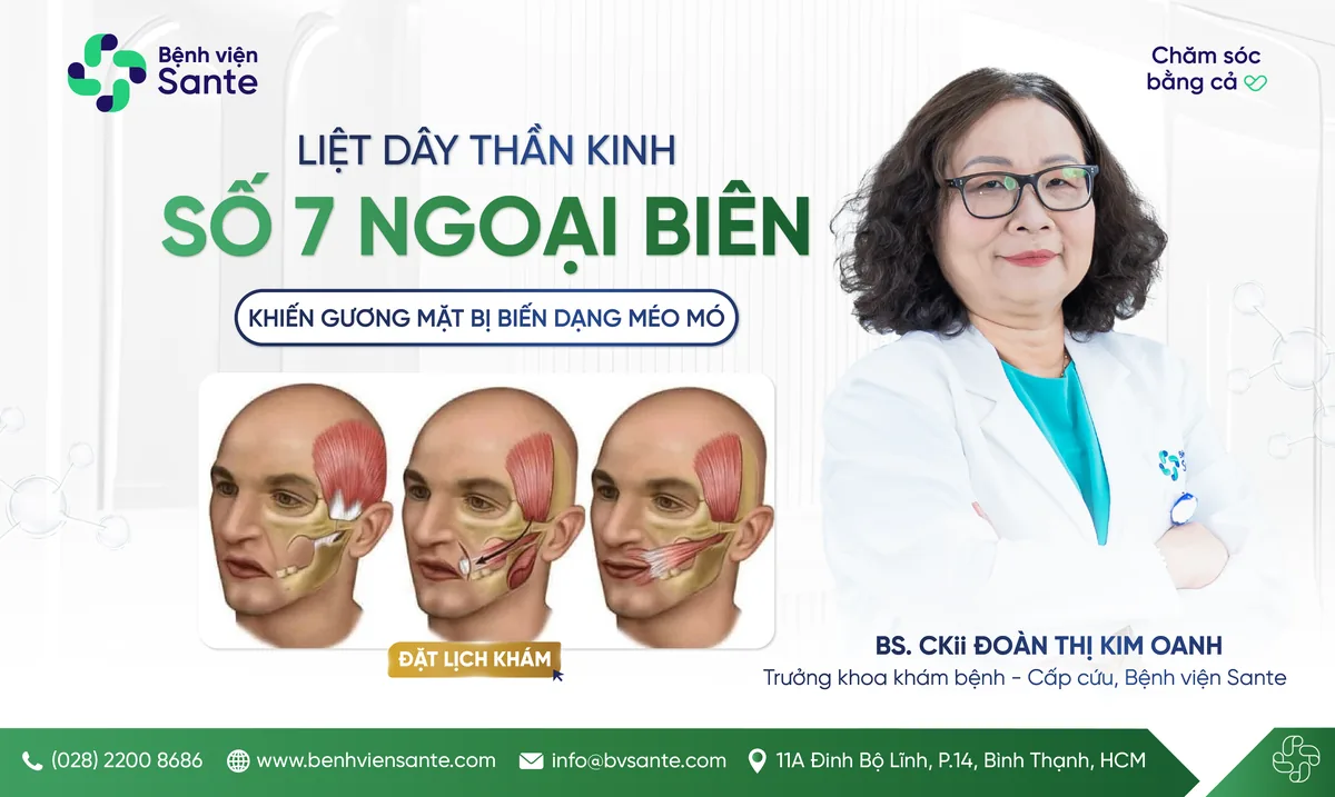 Peripheral facial nerve palsy (Bell's palsy), A CONDITION CAUSING FACIAL ASYMMETRY AND DEFORMITY - SANTE Hospital, Binh Thanh, HCMC