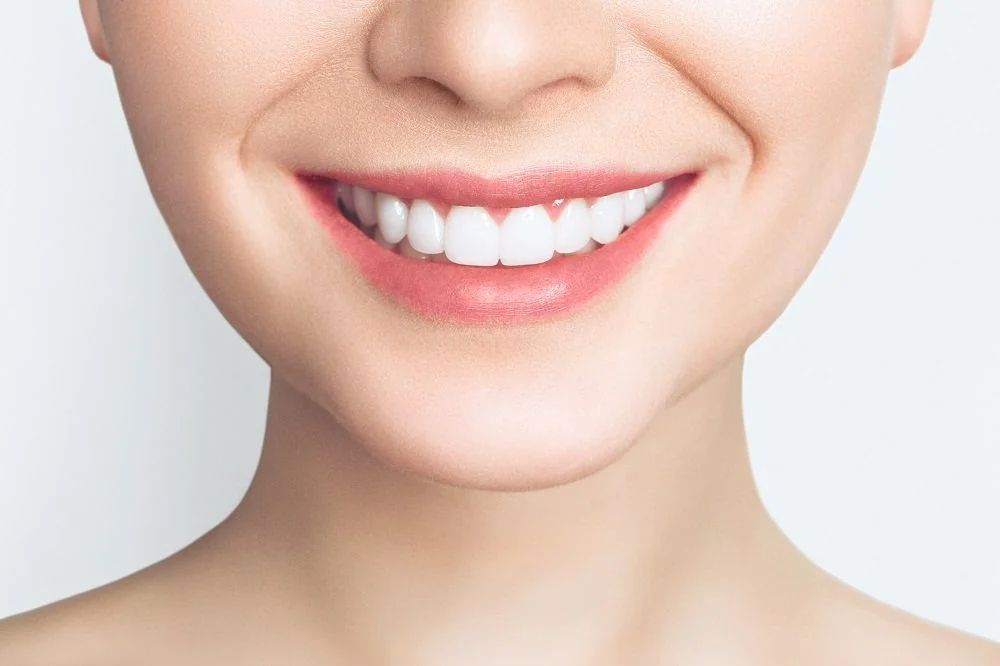 Sante Hospital - Porcelain Veneers (Dental Veneers) (Image 3)