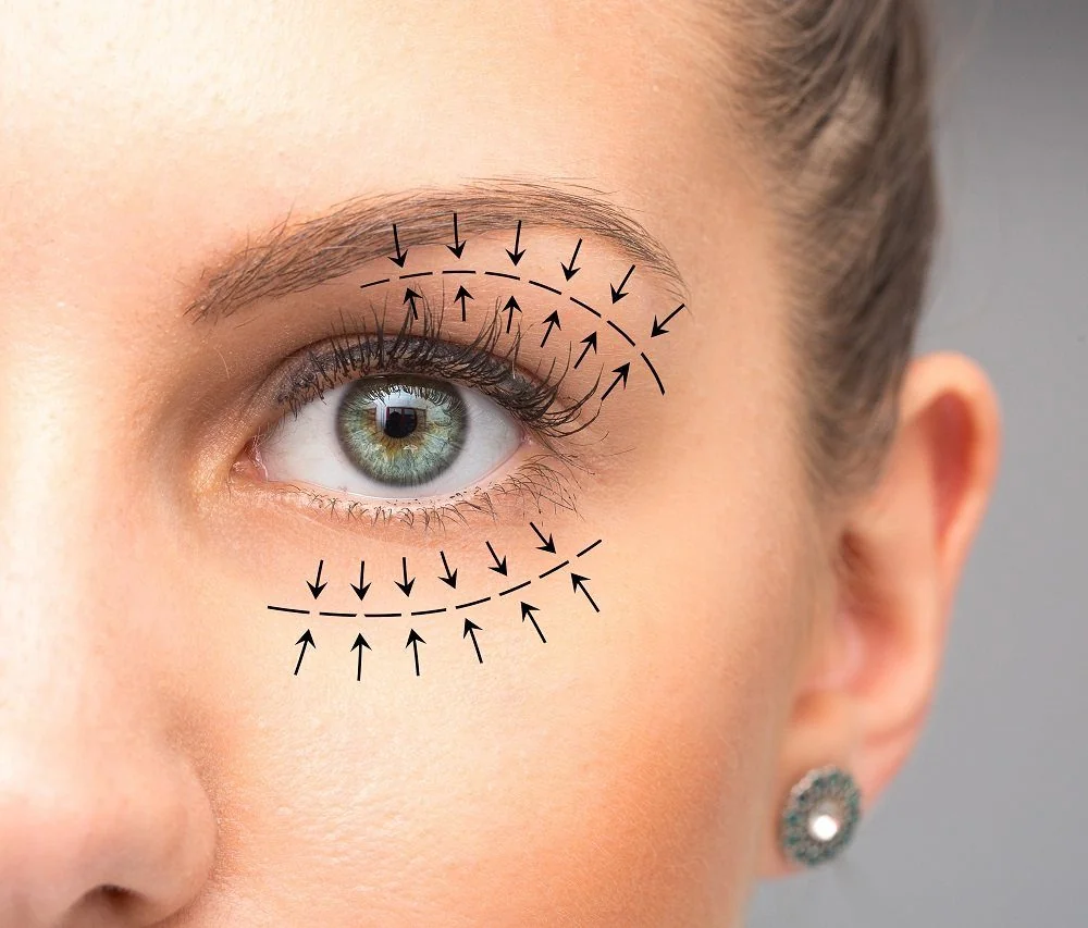Sante Hospital - Aesthetic Blepharoplasty & Eye Plastic Surgery Sante Hospital - Aesthetic Blepharoplasty & Eye Plastic Surgery