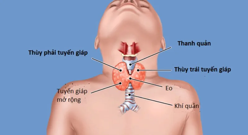 Sante Hospital - What Is Hyperthyroidism? Causes, Signs, and Treatment Sante Hospital - What Is Hyperthyroidism? Causes, Signs, and Treatment