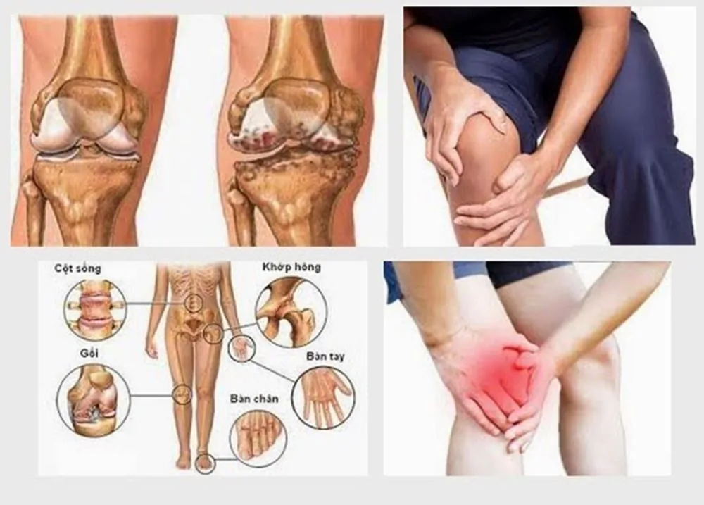 Sante Hospital - Causes of Joint Pain? Symptoms and Treatment (Image 3)
