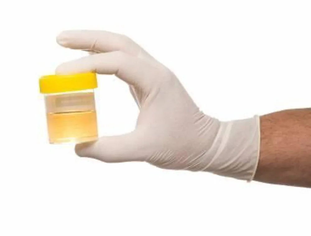 Sante Hospital - Pediatric Urinary Tract Infection (Figure 2)