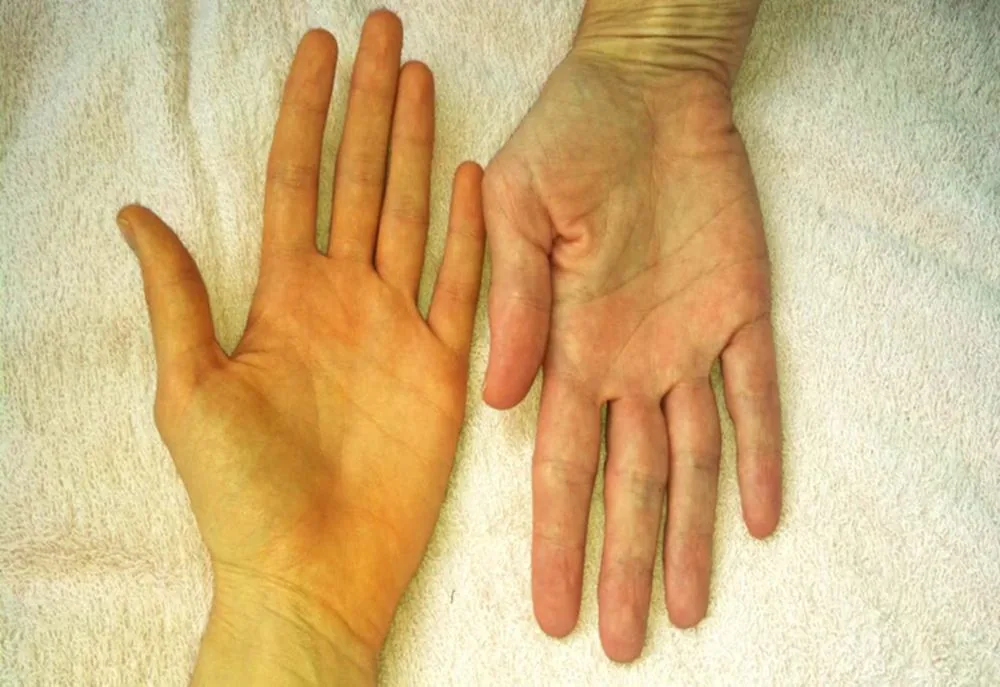 Sante Hospital - Symptoms of Liver Cancer_ Causes_ High-Risk Groups (Image 2)