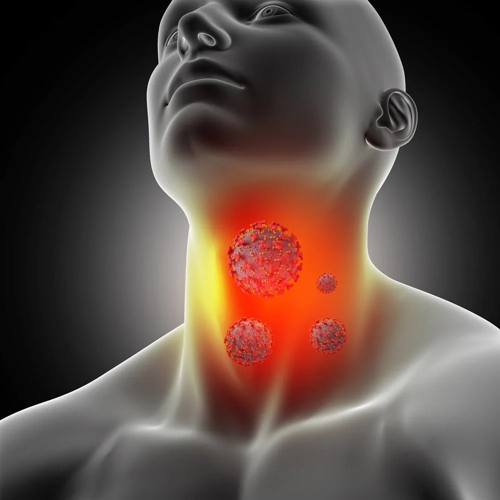 Sante Hospital - What Is Acute Pharyngitis? Causes, Symptoms, and Prevention (Figure 2)