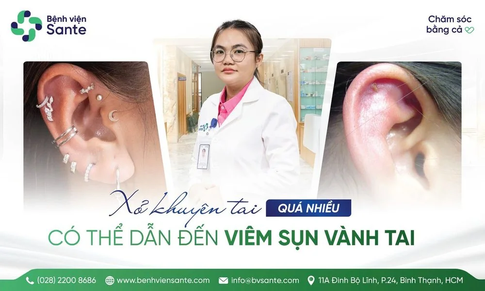 EXCESSIVE EAR PIERCING LEADING TO AURICULAR PERICHONDRITIS - SANTE Hospital, Binh Thanh, HCMC
