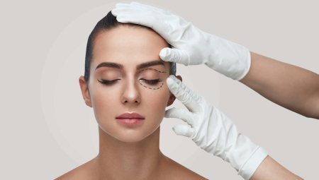Aesthetic Oculoplastic Surgery