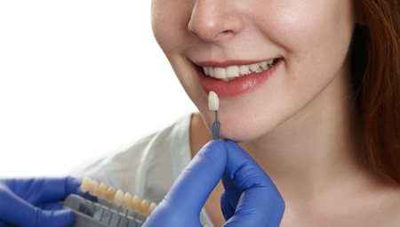 Porcelain Veneers