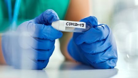 COVID-19 Rapid Antigen and Real-Time PCR Testing