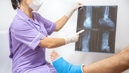 Splinting and casting immobilization for fractures