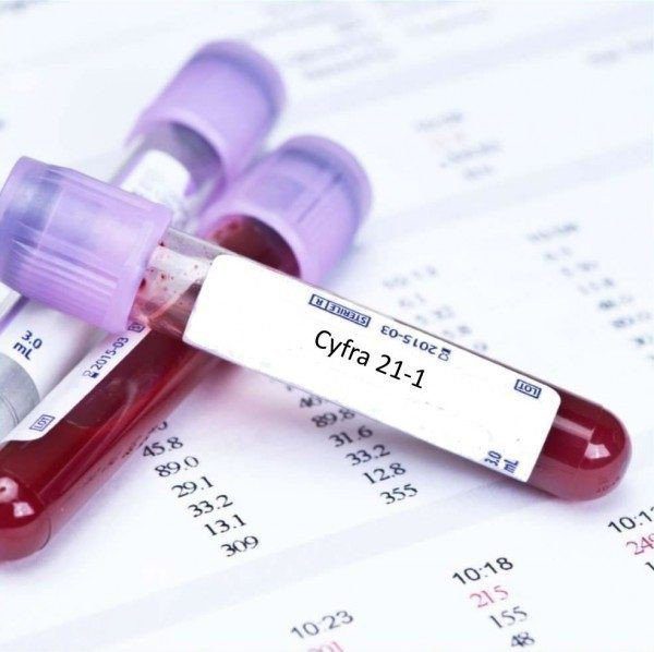 Gold-Standard Diagnostic Evaluations and Screenings for Precise Lung Cancer Detection