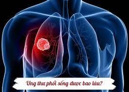 Lung Cancer Prognosis and Survival Rates by Clinical Stage