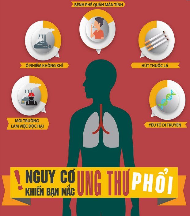 Causes of lung cancer, influencing factors, and prevention methods.