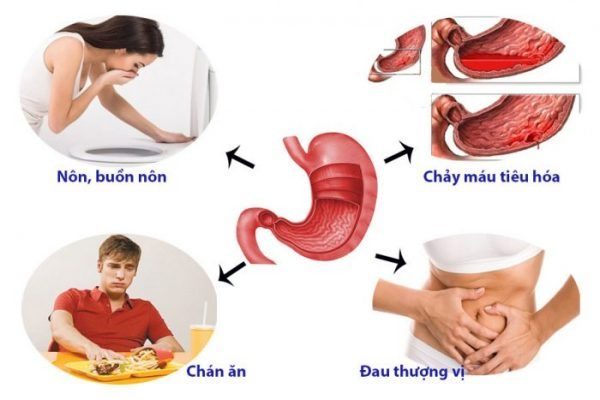 Stomach Pain: Symptoms, treatment methods, and prevention.