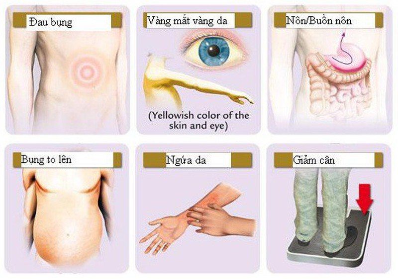 Symptoms of liver cancer, causes, and at-risk populations.