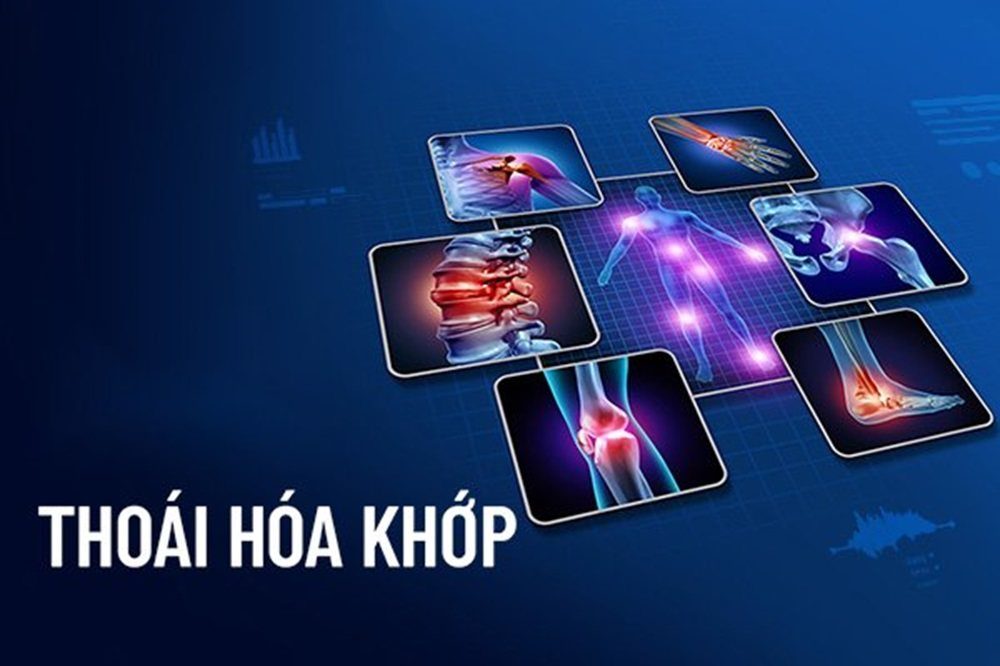 Osteoarthritis