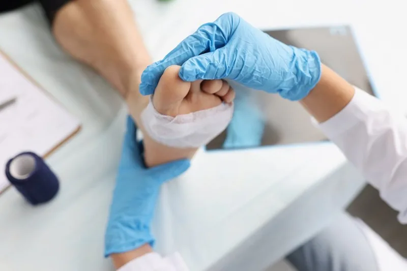 Diabetic Foot Complications