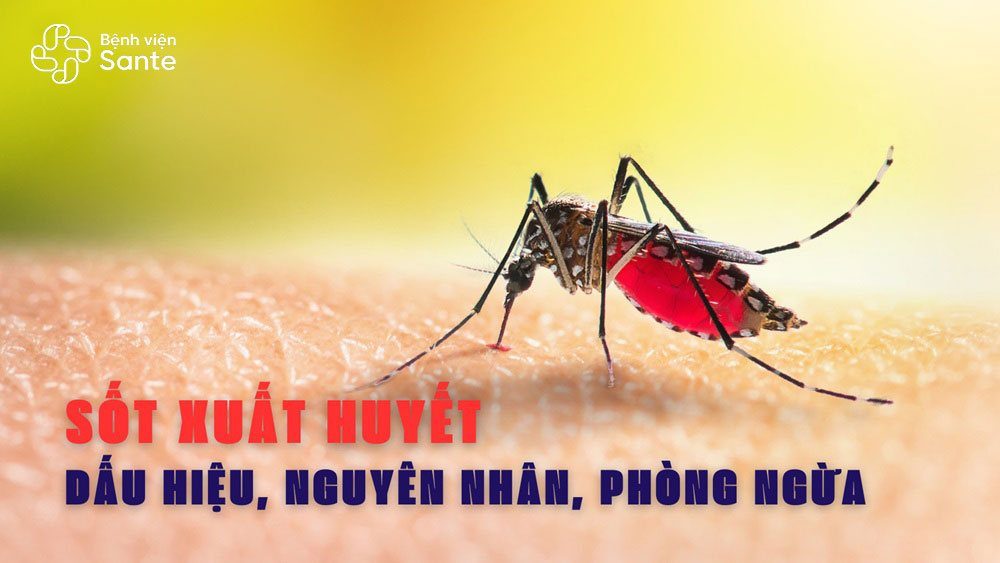 Dengue Fever