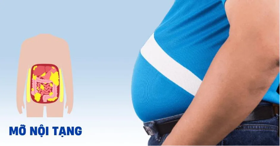 CAUSES OF VISCERAL FAT - Figure 2 - SANTE Hospital, Binh Thanh, HCMC