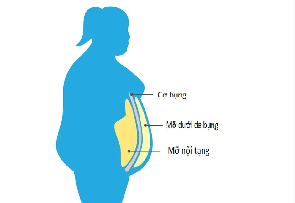 CAUSES OF VISCERAL FAT - Image 3 - SANTE Hospital, Binh Thanh, HCMC CAUSES OF VISCERAL FAT - Image 3 - SANTE Hospital, Binh Thanh, HCMC