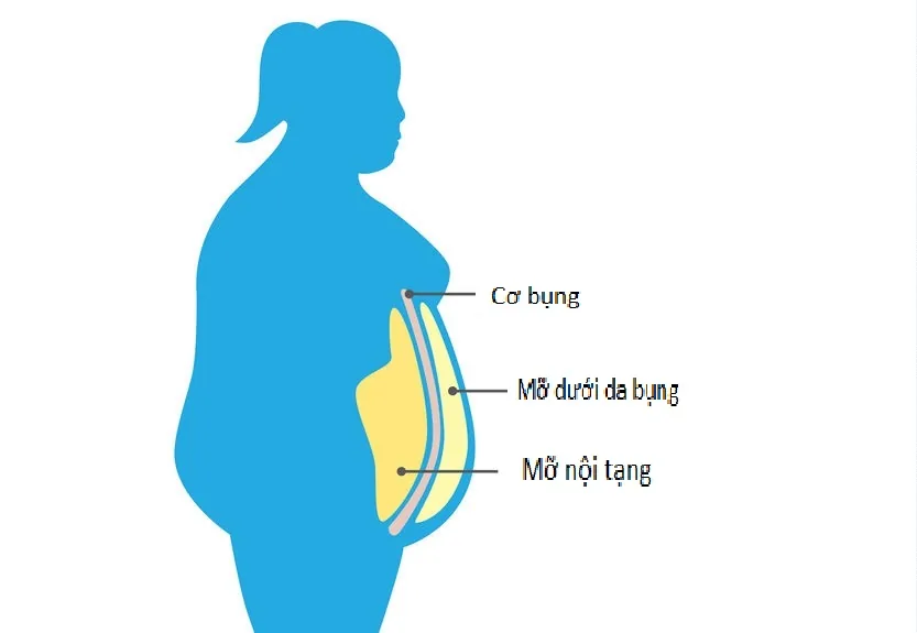 내장지방의 원인 - 이미지 3 - 산테 병원, 호치민시 빈탄 내장지방의 원인 - 이미지 3 - 산테 병원, 호치민시 빈탄