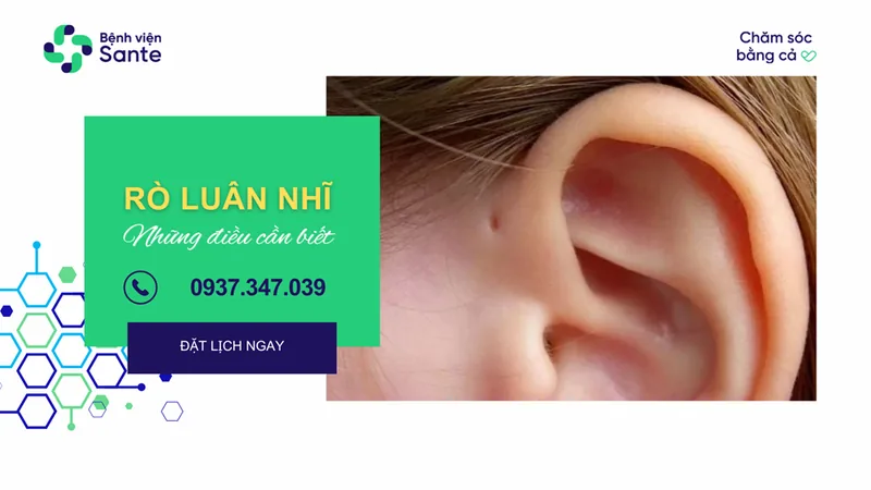 Preauricular Sinus: Essential Insights - SANTE Hospital Binh Thanh, HCMC Preauricular Sinus: Essential Insights - SANTE Hospital Binh Thanh, HCMC