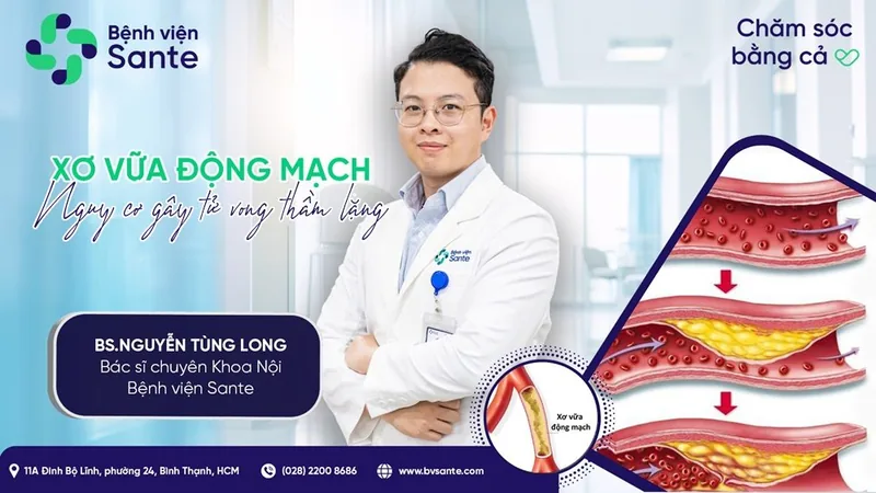 Atherosclerosis: A Silent Life-Threatening Risk - SANTE Hospital, Binh Thanh District, HCMC