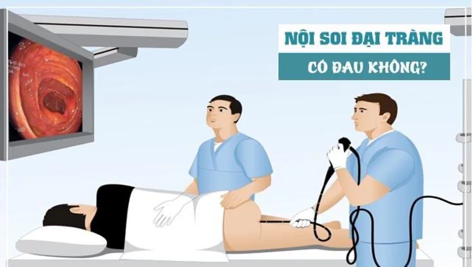 Colorectal Cancer Screening Modalities - Image 3 - SANTE Hospital, Binh Thanh, HCMC